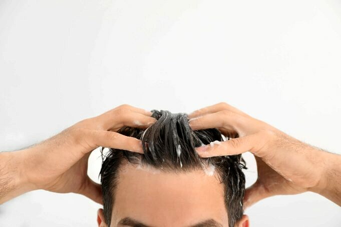 Koennen Schuppen Haarausfall Verursachen